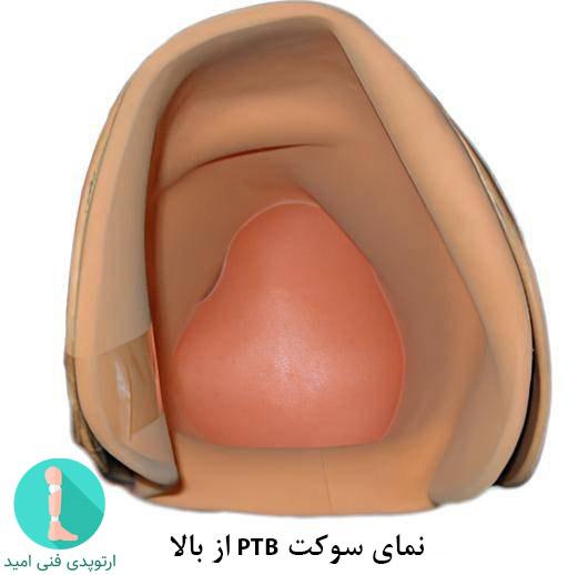 سوکت با تحمل وزن از کشکک زانو (PTB) 
