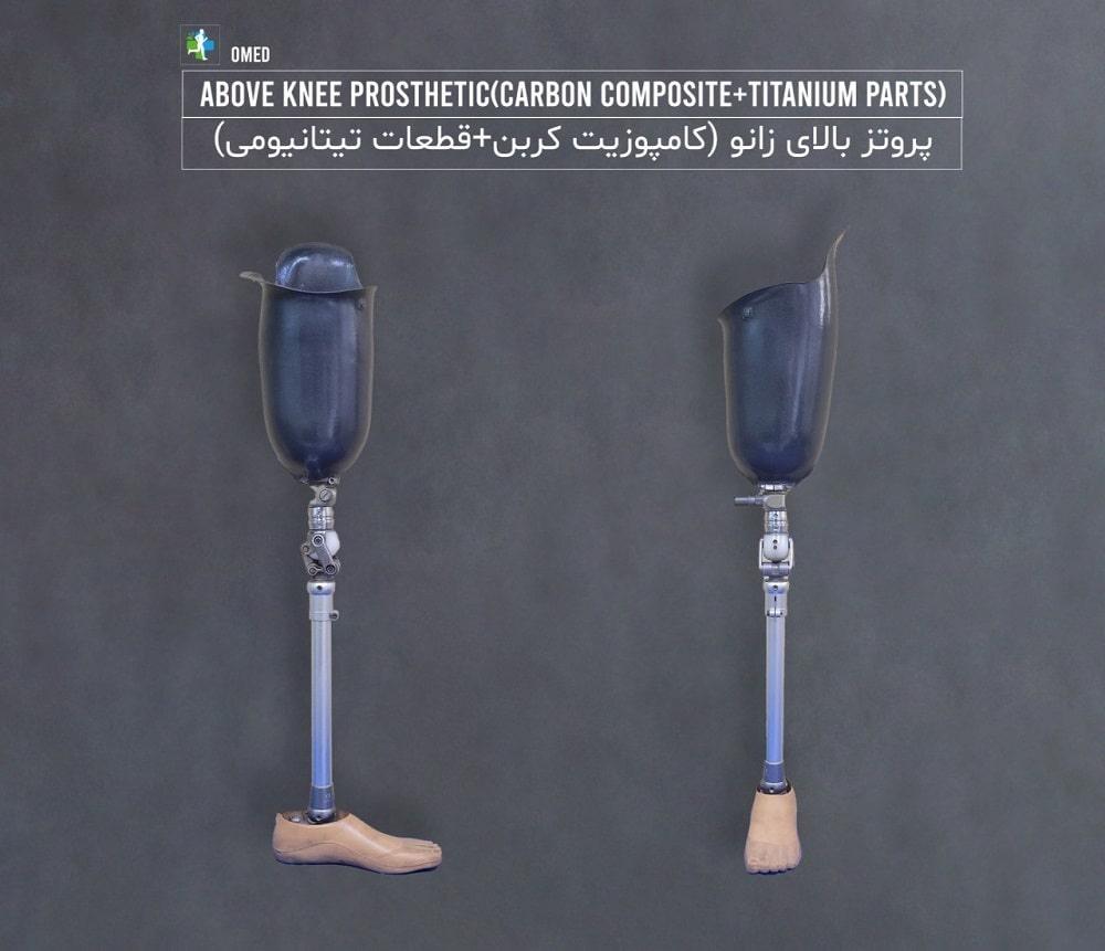 پروتز بالای زانو
