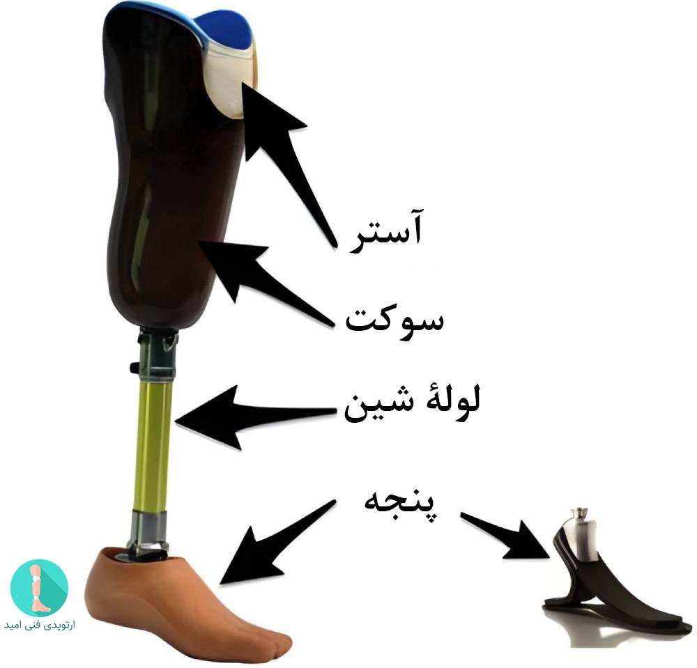 پروتز زیر زانو از چه اجزایی تشکیل شده است؟