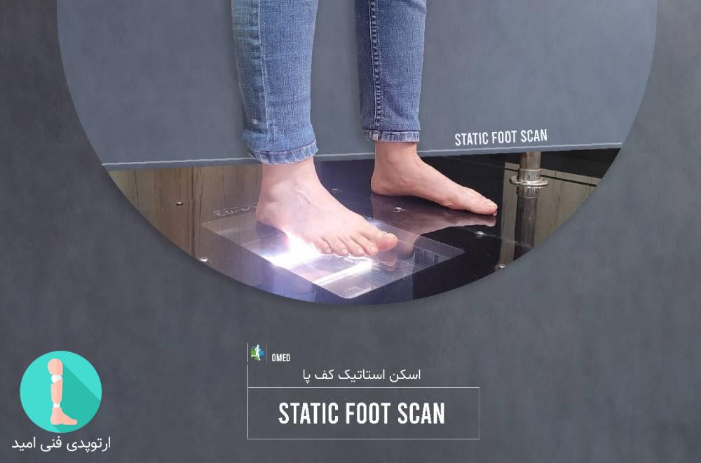 طراحی و ساخت کفی، کفش و صندل طبی برای خار پاشنه با اسکت استایک