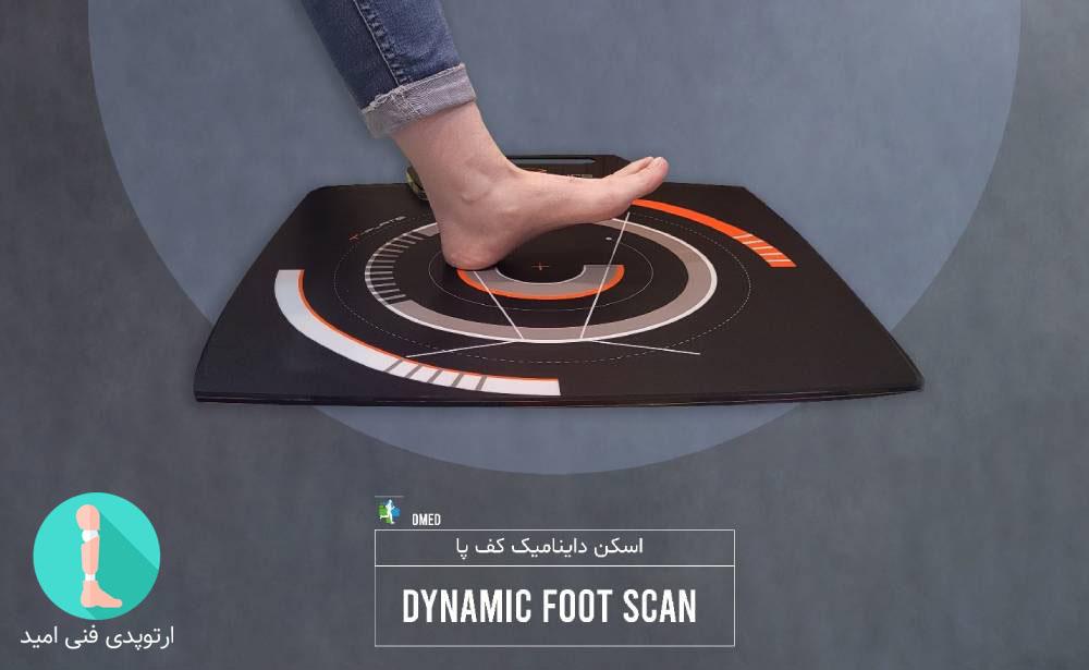طراحی و ساخت کفی، کفش و صندل طبی برای خار پاشنه با اسکن داینامیک