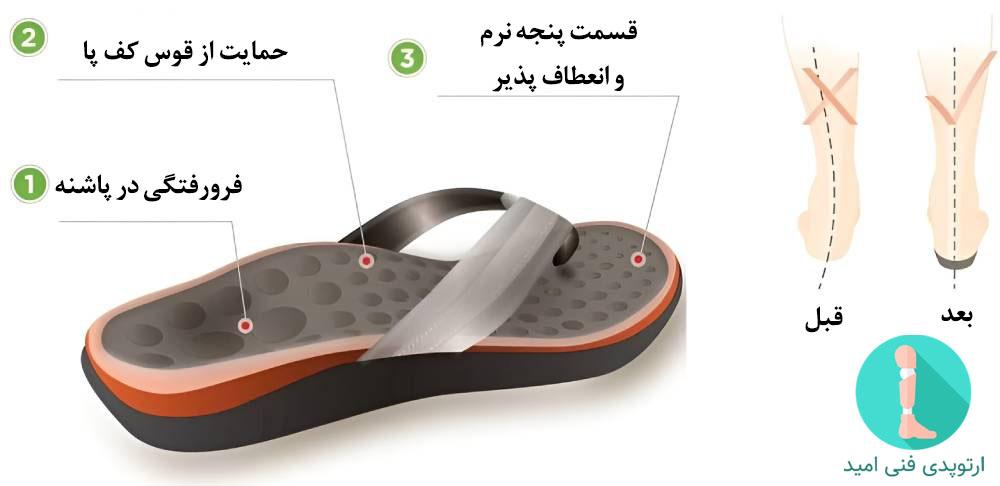 صندل طبی خار پاشنه