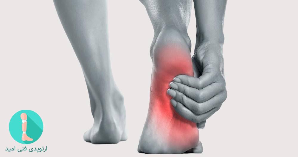 چه کسانی می‌توانند برای اسکن پا به مرکز امید مراجعه کنند؟