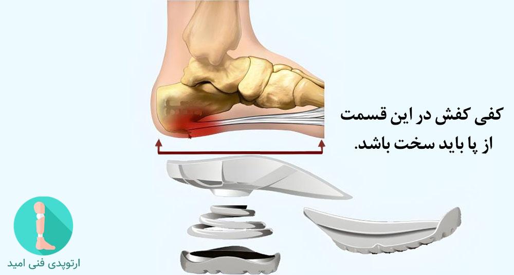 کفش طبی خار پاشنه