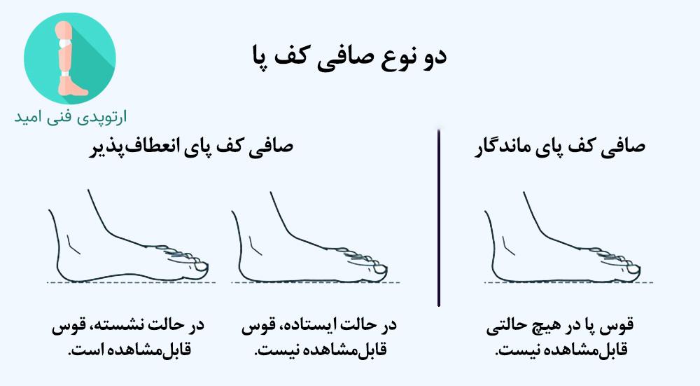 درمان صافی کف پا در کودکان ۴ تا 10 سال