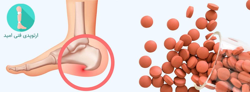قرصهای ضدالتهاب برای کاهش درد و التهاب خار پاشنه