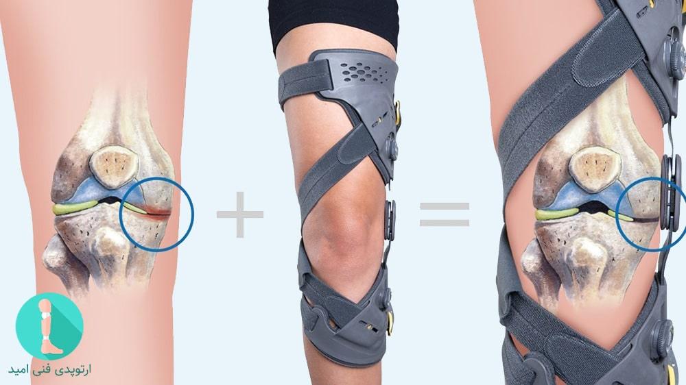 بریس Unloader Knee 